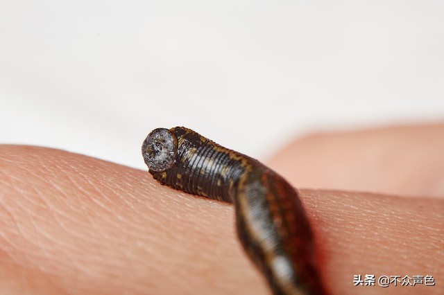 蚂蝗吸血时会传染寄生虫吗,误吞了蚂蝗怎么办