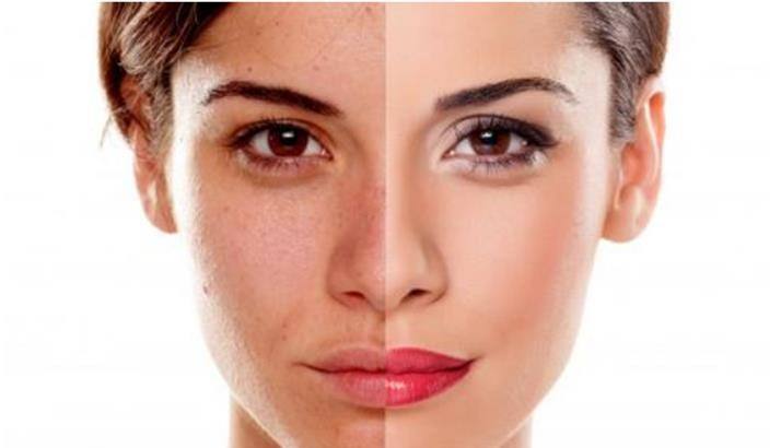 黄脸婆暗黄皮肤,解决皮肤暗黄最好的方法