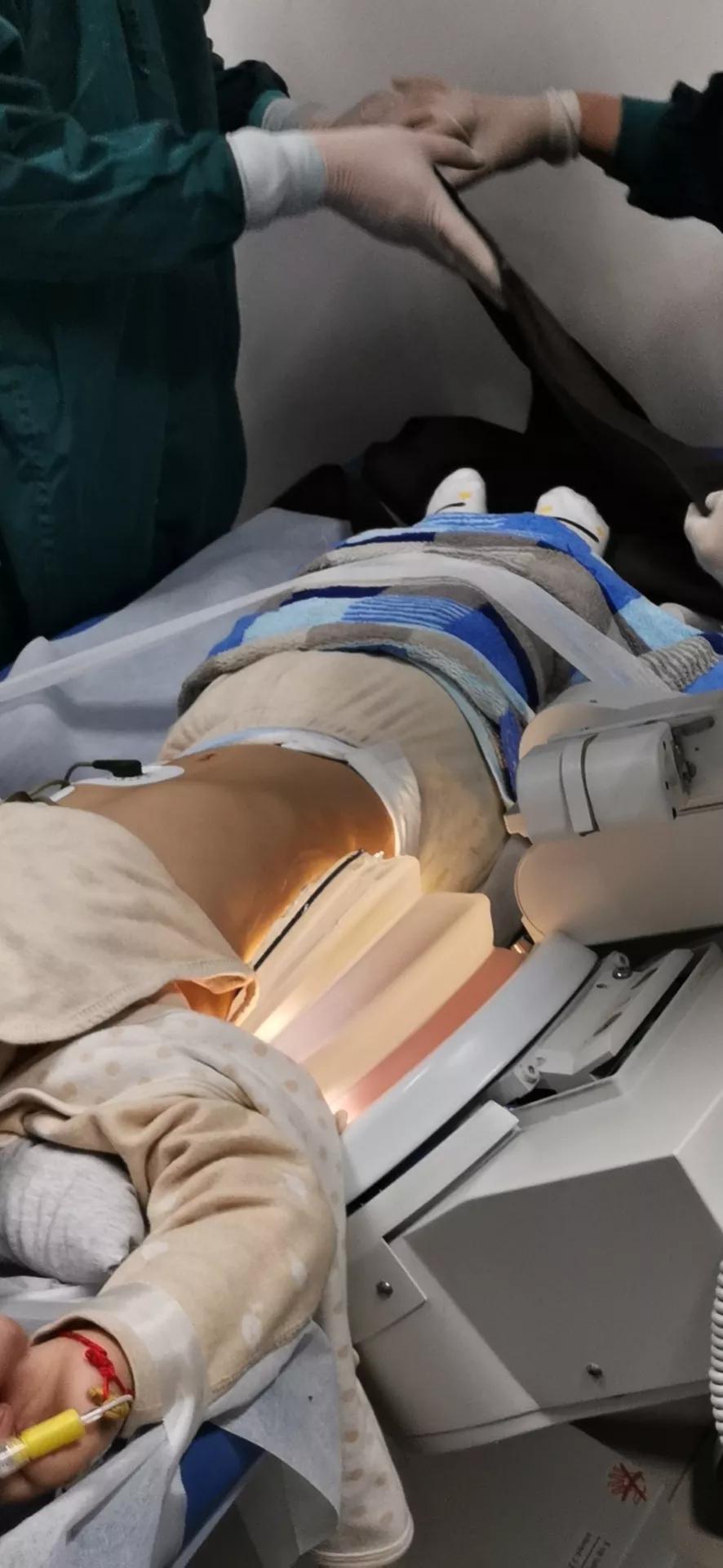 小儿尿道结石如何碎石,小儿尿结石