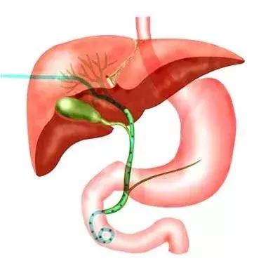 超声引导下的微创介入诊疗技术,超声引导下的神经阻滞技术电子版