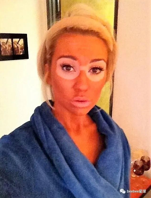 为什么老特的眼袋是白色的？