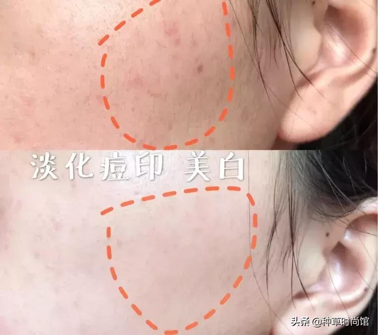 脸色暗黄干皮怎么变白最快方法,暗黄皮用什么护肤品变白