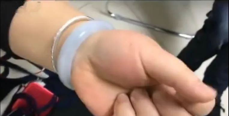 手镯戴了可以随意取吗,手镯戴手上取不下来怎么鉴定真假