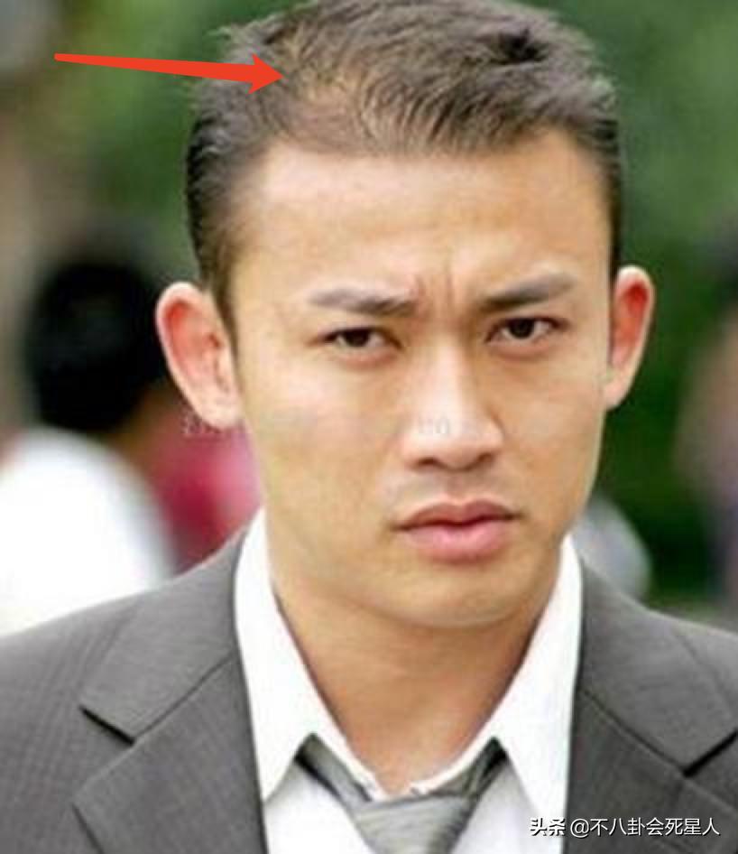 黄晓明和沙溢最新视频,沙溢秃顶视频