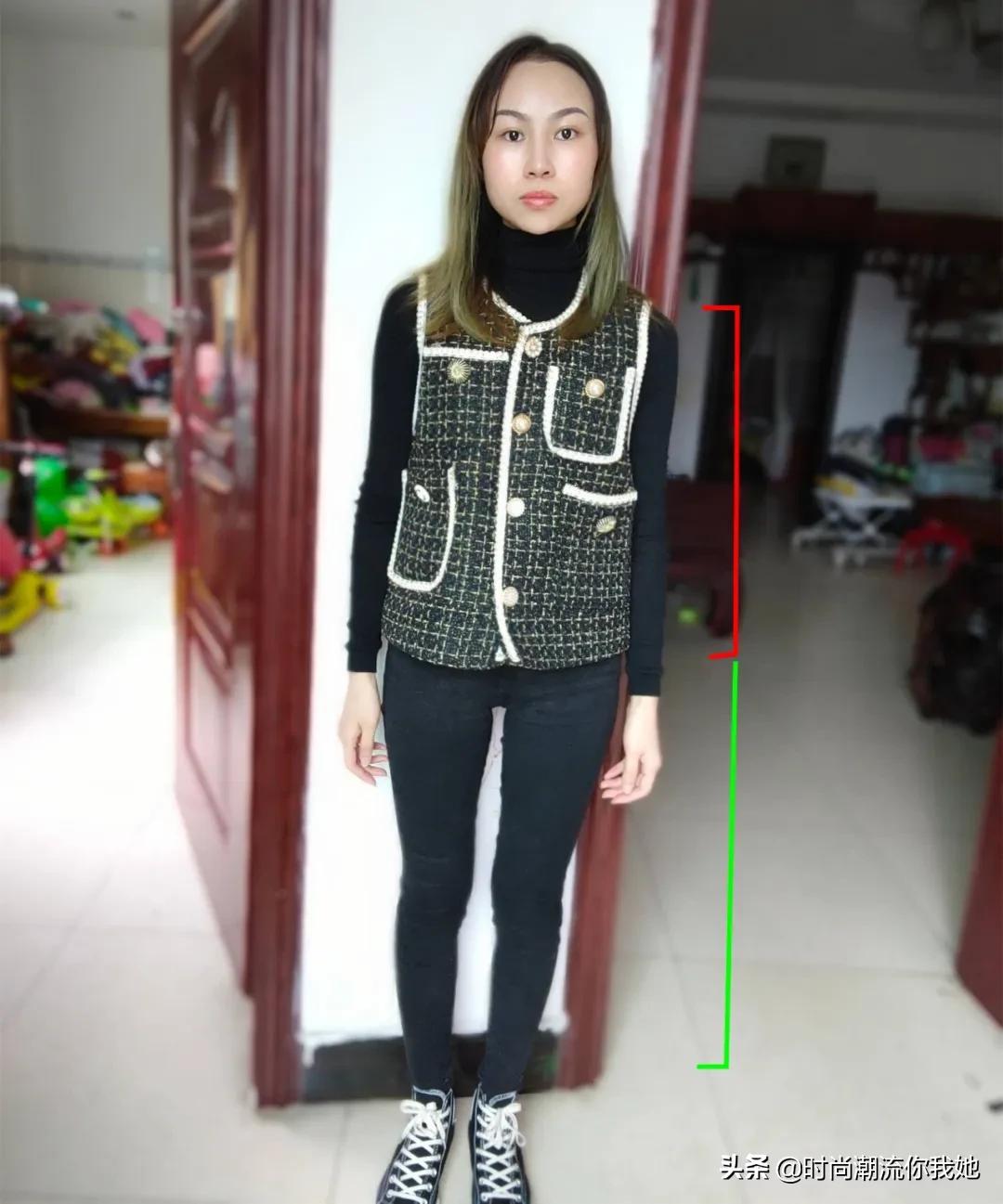 单眼皮凸嘴素人改造,肿眼泡整容成功案例