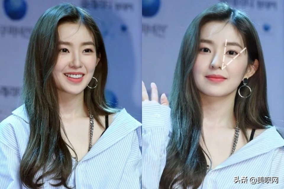 韩国整容模板jennie,韩国整形面容