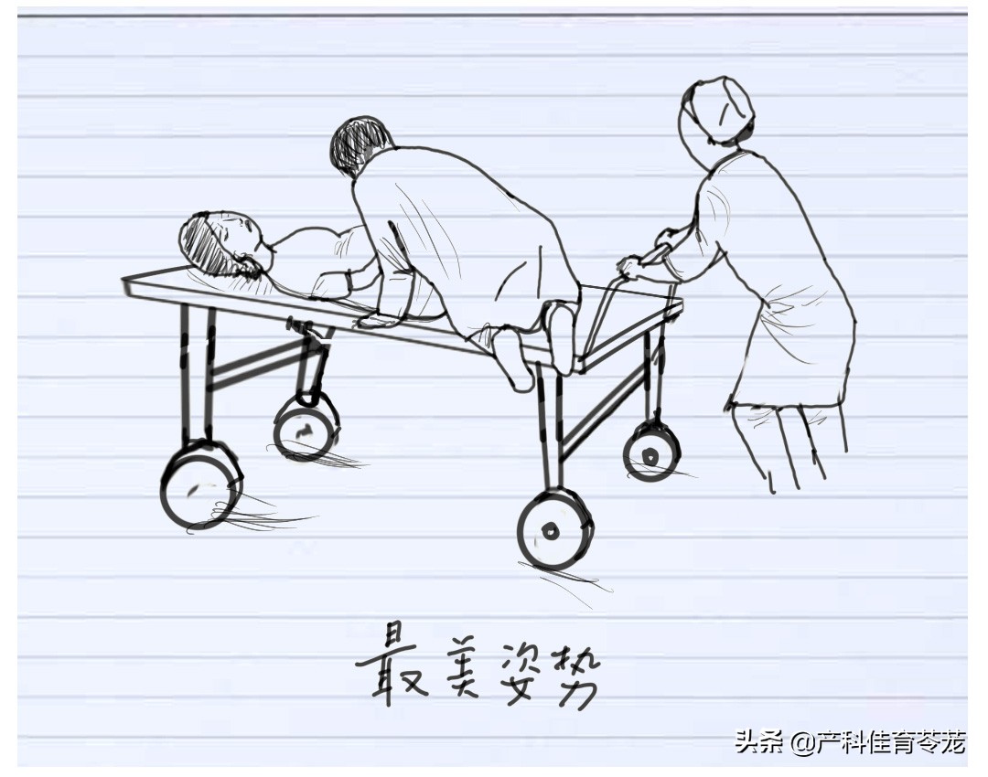 脐带脱垂，破水以后最害怕的事儿