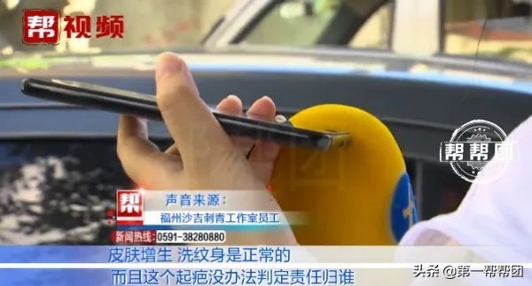 洗纹身后发炎起脓会留疤吗,洗纹身后起水泡了会留疤吗