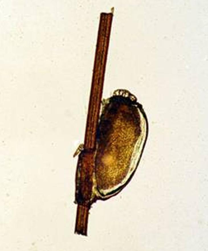 30年前每个人身上都有虱子,30年前人人都有的虱子为什么不见