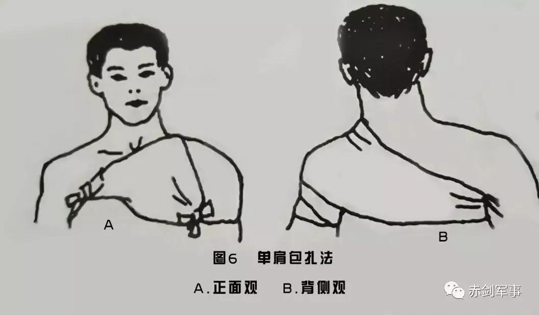 军队三角巾包扎法视频,部队卫生与救护三角巾包扎方法