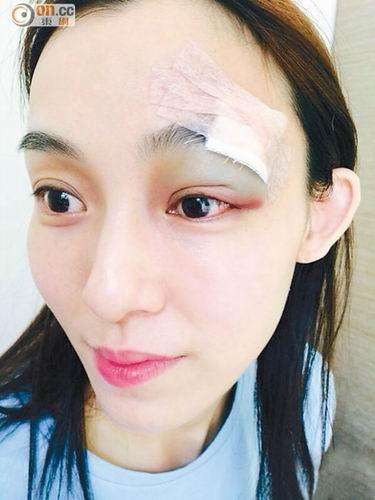 范玮琪摔倒陈建州,范玮琪摔伤的原因