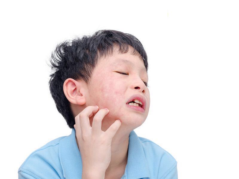 小孩皮肤过敏反复很痒怎么办,小孩皮肤过敏痒最好的解决方法