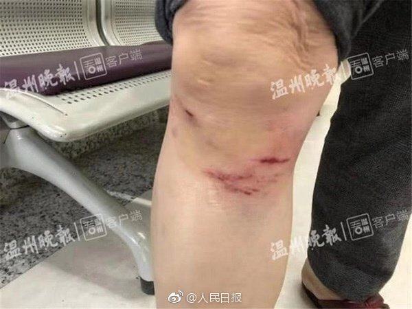 新郑婚礼爆炸事件,郑州新郑爆炸新闻最新