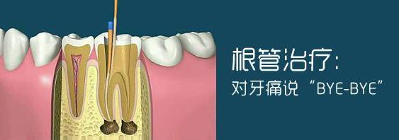 冠心病引起的牙疼与牙病的区别,除了牙病以外什么病能引起牙疼