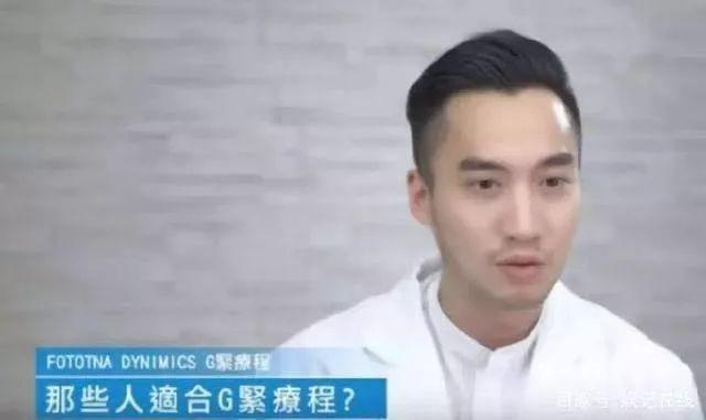 阿娇演港女,阿娇不笑和笑起来的对比照