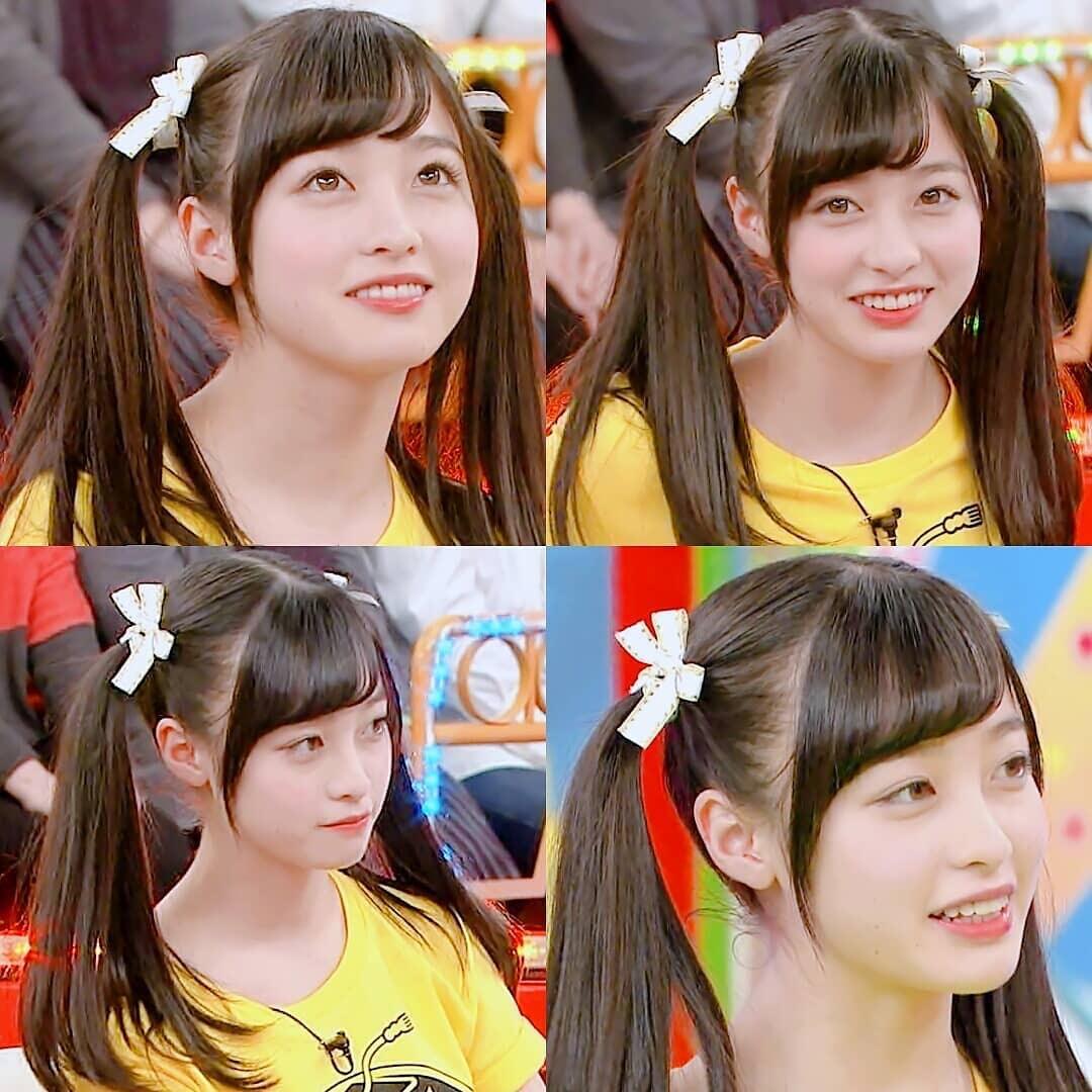 双眼皮科普小课堂：双眼皮的三种术式及术后护理