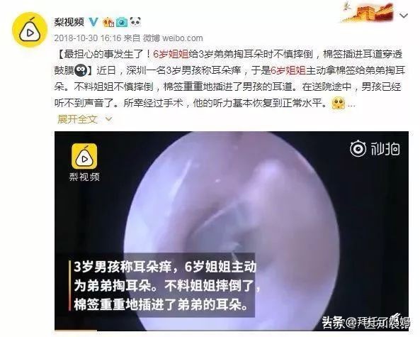 宝宝有耳屎家长一定不能这样做,男孩不掏耳屎进医院