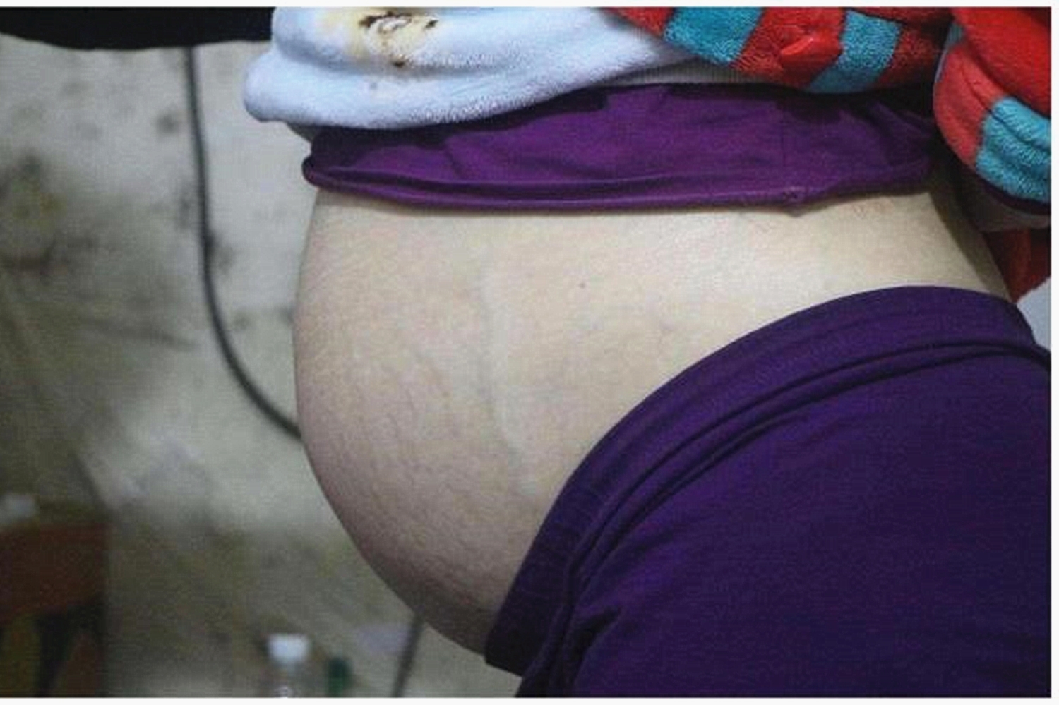 40岁孕妇妊娠43周胎儿仍不出来，去医院检查，医生痛批：糊涂