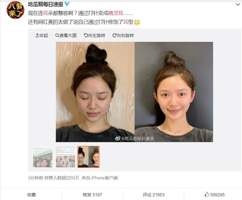 女子花50万整容被骗,女子花6万块整容被朋友毁容了