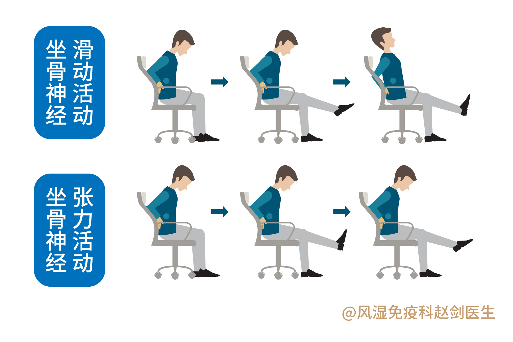 腰椎间盘突出要少运动？不宜跑步和健步走？医生：正确运动康复快