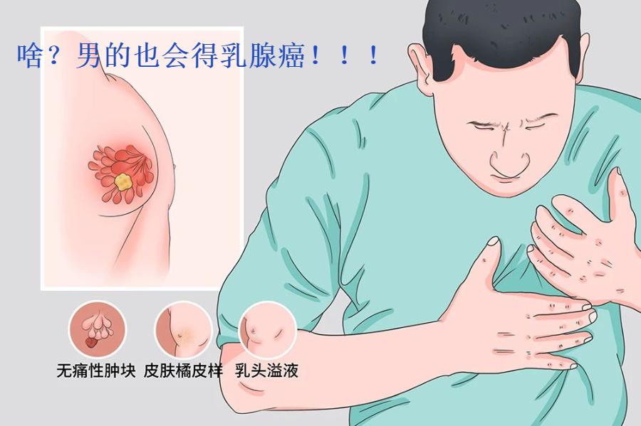 男性胸部凸出肥大,男性胸部有乳腺吗