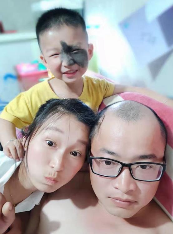 5岁男孩头上长500克重“气球”，历尽5年艰辛只为早日换脸