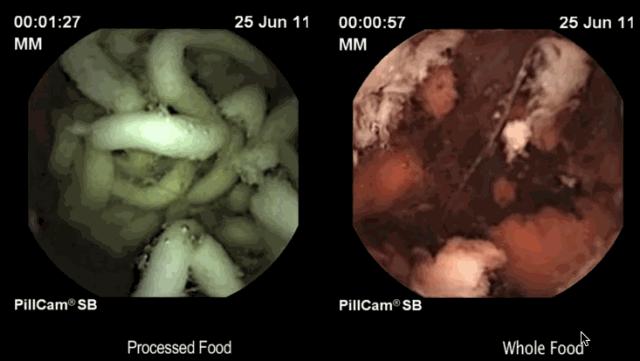 吃泡面多了会不会变木乃伊,面条吃多了能变成木乃伊吗