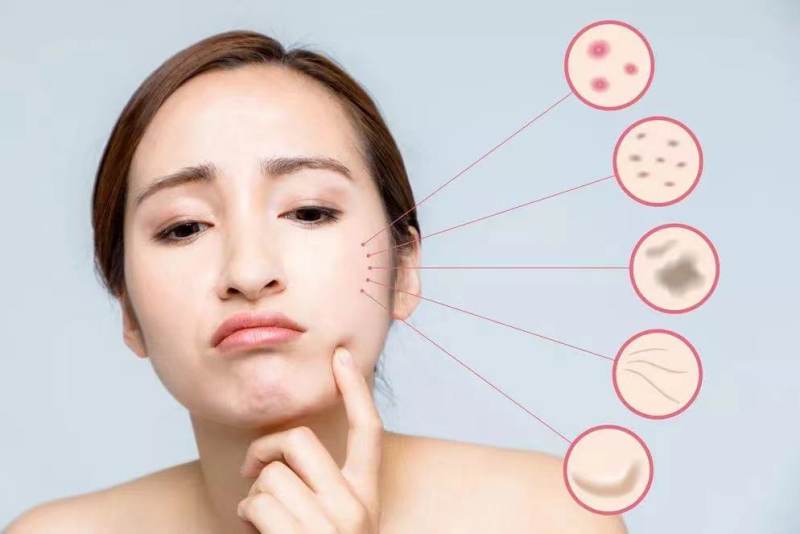 可思美净肤仪测评,可思美等离子美容仪