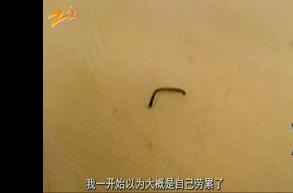 女子住酒店被针扎伤,女子住酒店买艾滋病阻断药