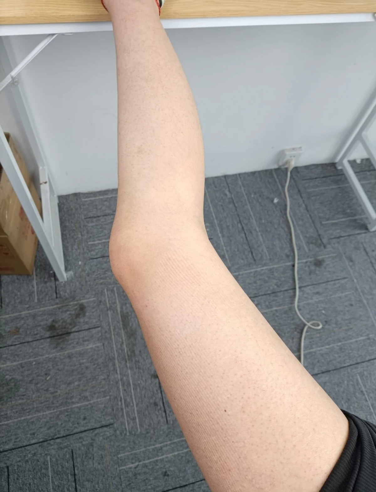 去鸡皮肤亲身经历,鸡皮蜕变