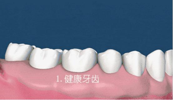 洗牙牙齿问题,医院口腔科洗牙和外面洗牙区别