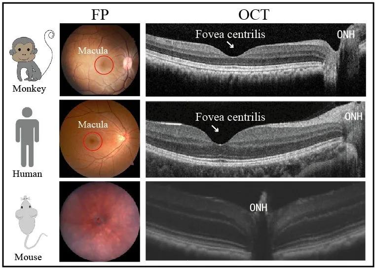 发现新型白化眼病猕猴模型,有望突破治疗人类眼皮肤白化病瓶颈|金子兵和占龙团队