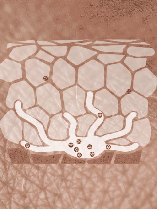 人身上长的黑痣瘊子能变癌症吗,手上长小黑痣会是癌症信号吗