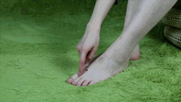 39岁男子查出肝癌,35岁男子查出肝癌身上有特殊记号