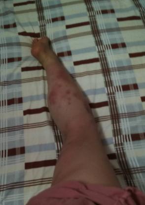 拍打膀胱有什么好处,拍打膀胱有助排尿吗