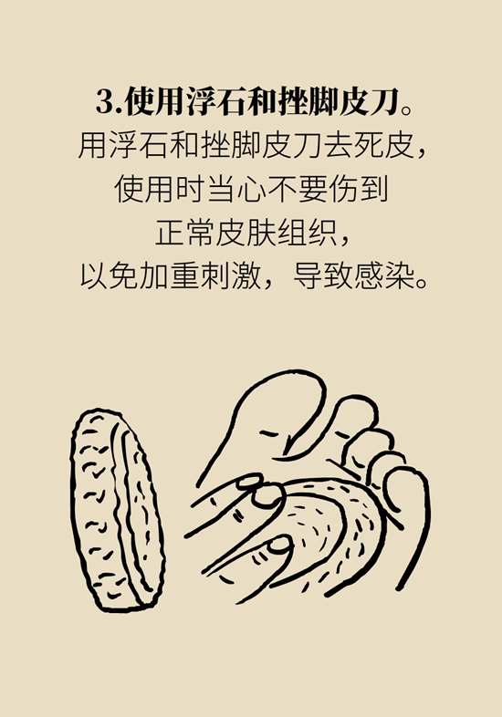 长了鸡眼该怎么办四大妙招教给你,长了鸡眼怎么治疗好得快