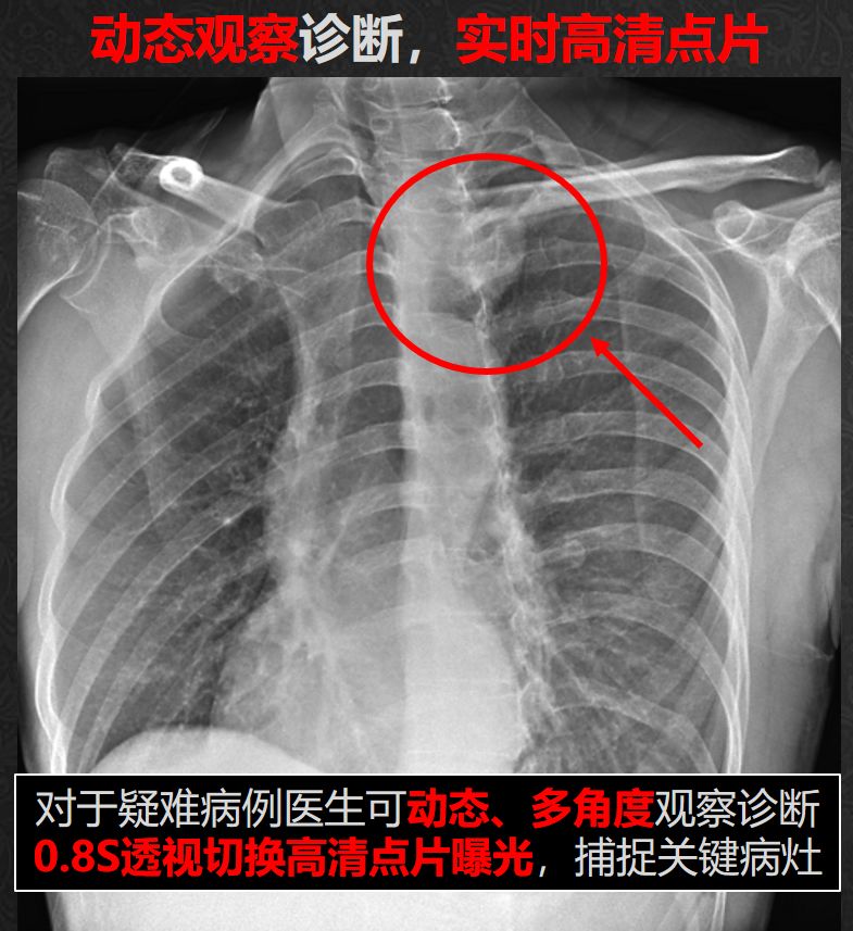专访ChinaMed上的安健科技——“动态DR不是我们的终点!”