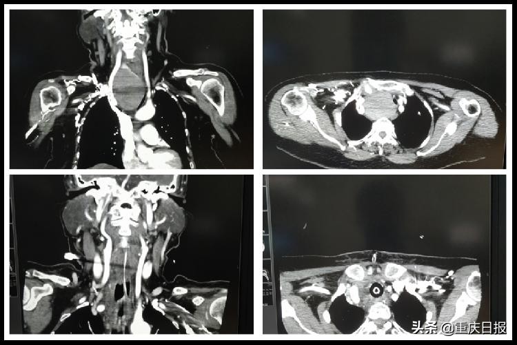 多学科医生协作救治,多学科医生团队协作