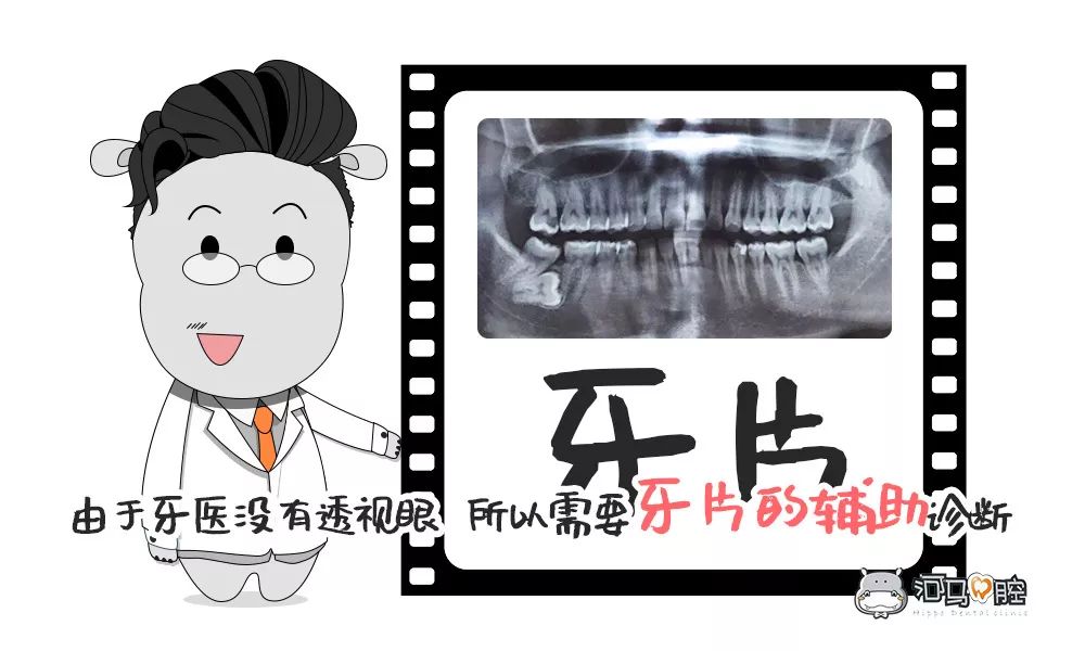 小孩看牙拍片辐射影响大吗,拍牙片对儿童辐射大么