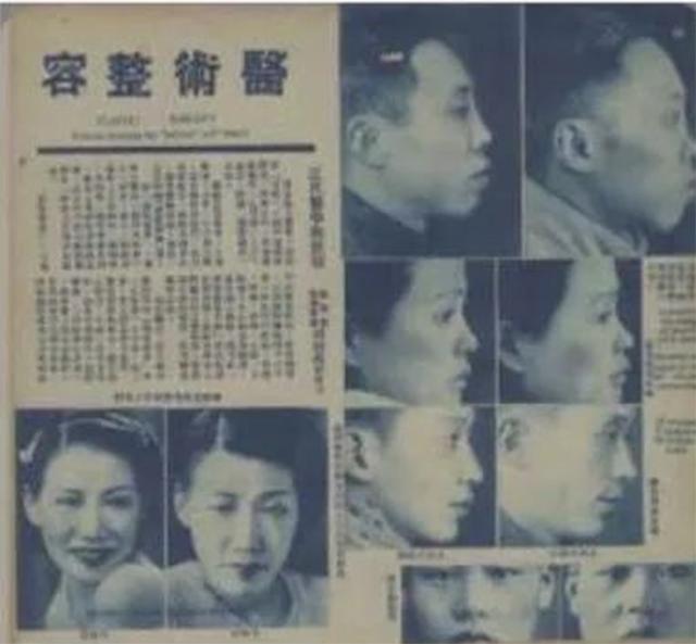 上海整容名媛,上海整容医院排前十名割眼袋