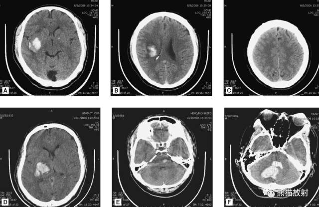 值夜班需要注意什么身体健康,值夜班的十大危害