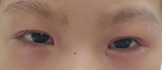 3岁小孩平时爱挑眉、耸肩，医生却说不是坏习惯？