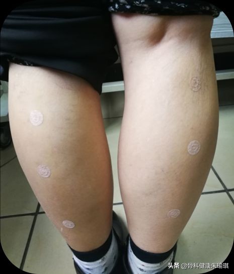 老年人腿抽筋常见,发生原因众多,最新防治方法来啦