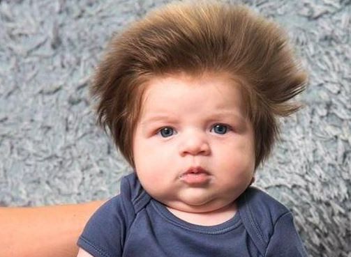 婴儿一出生就满头黑发好吗,为什么有的孩子出生黄头发