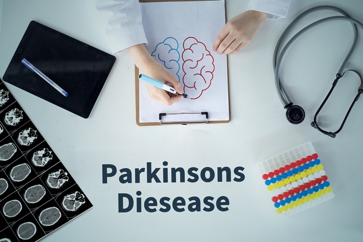 年纪轻轻就忘事是为什么,怎么解决忘性大的问题