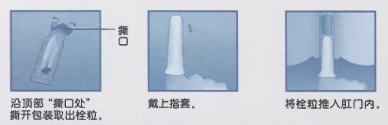 必看！你可能用错痔疮药了