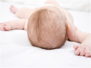 婴儿头发黄稀疏是什么原因,新生儿头发稀少需要吃什么