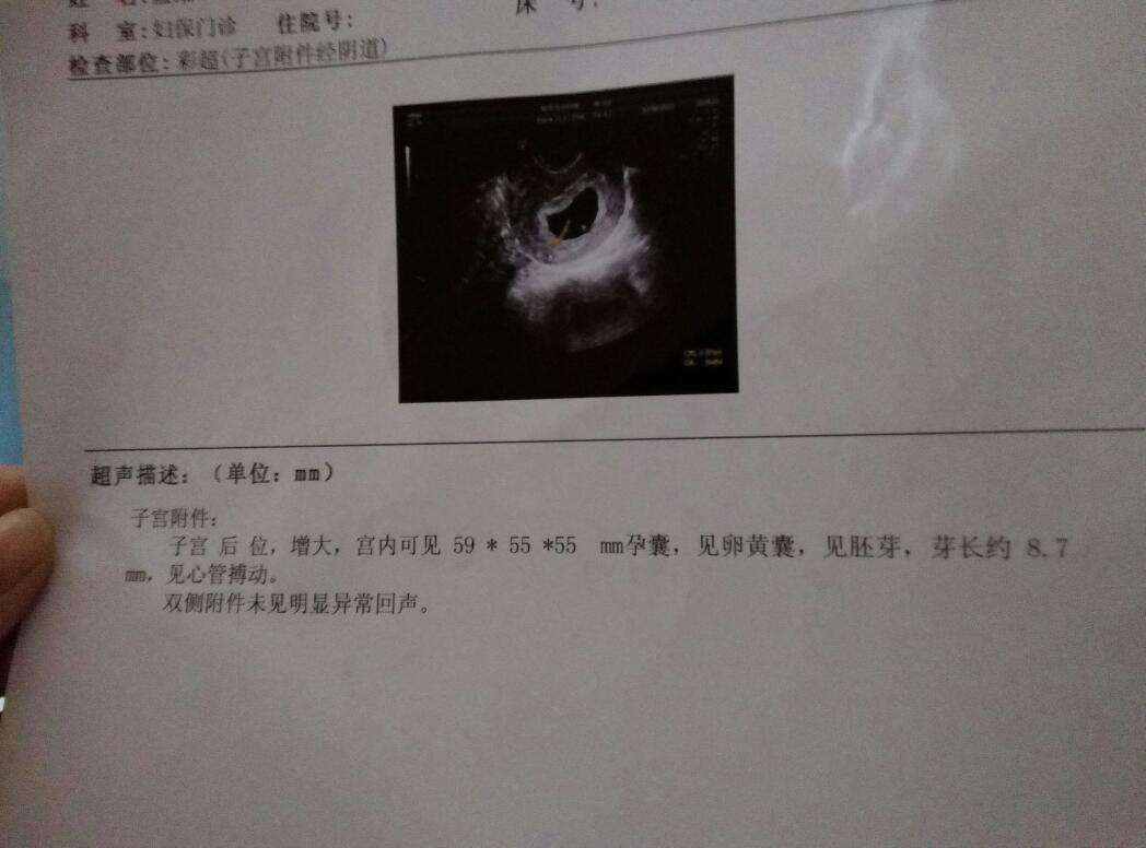 试管8周无胎芽胎心能要吗,8周未见胎心管搏动有救吗