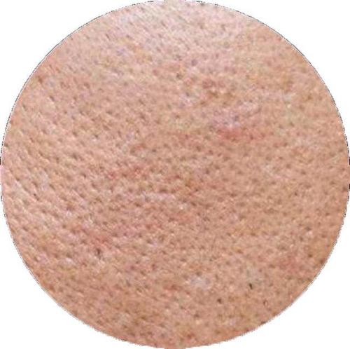 毛孔粗大用什么药膏可以收缩毛孔,毛孔粗大抹啥药物能改善毛孔粗大