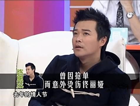 明星身上的伤疤,高晓松手臂的烟疤